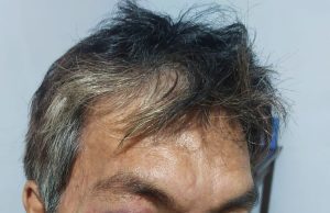 Polsek Kombi Terima Laporan Dugaan Penganiayaan di Desa Tulap