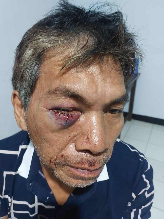 Polsek Kombi Terima Laporan Dugaan Penganiayaan di Desa Tulap